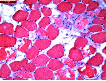 Histologisches Präparat des Musculus quadriceps femoris (Färbung: HE, Balken = 100 µm). Abbildung mit freundlicher Genehmigung