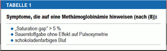 Tabelle