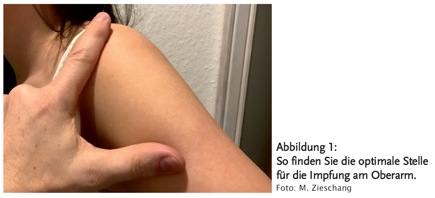 Abbildung 1: So finden Sie die optimale Stelle für die Impfung am Oberarm.