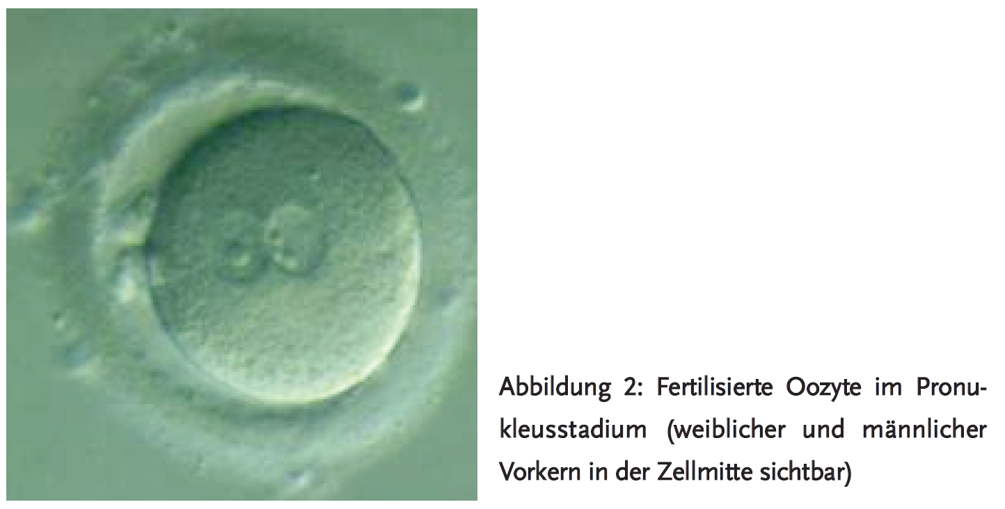 Abbildung 2: Fertilisierte Oozyte im Pronukleusstadium (weiblicher und männlicher Vorkern in der Zellmitte sichtbar)